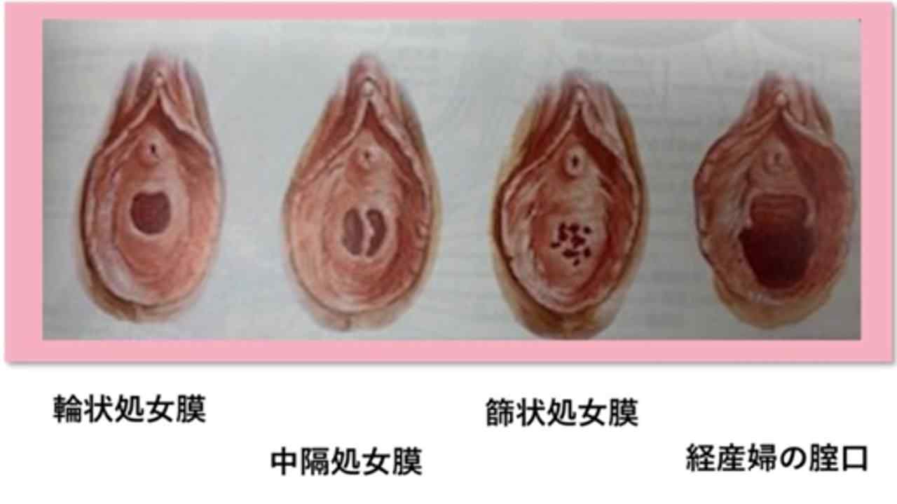 FC2-PPV-3514519 - 独占販売『処女喪失』、正真正銘の本物の処女喪失！！１８才、３ヶ月前まで高*●*生！！学費の支払いに困って、地方からわざわざ撮影に来ました！！処女喪失で人生初めての中出し、完全初撮影！！『個人撮影』個撮オリジナ thumbnail_8.jpg